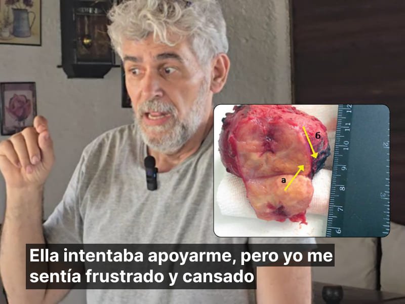 Testimonio ilustrativo - UroDoc